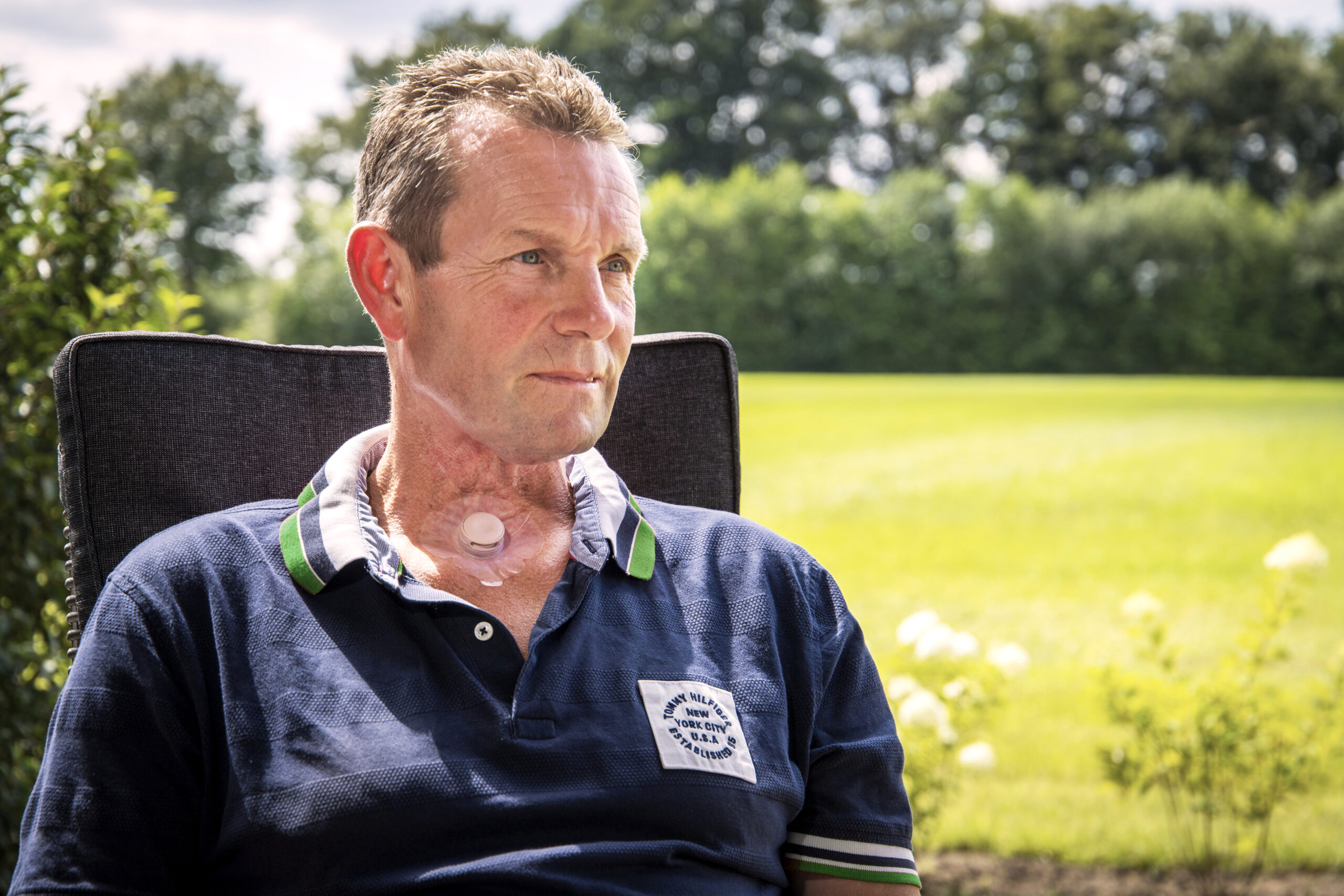 Man with laryngectomy stoma sitting outside in garden